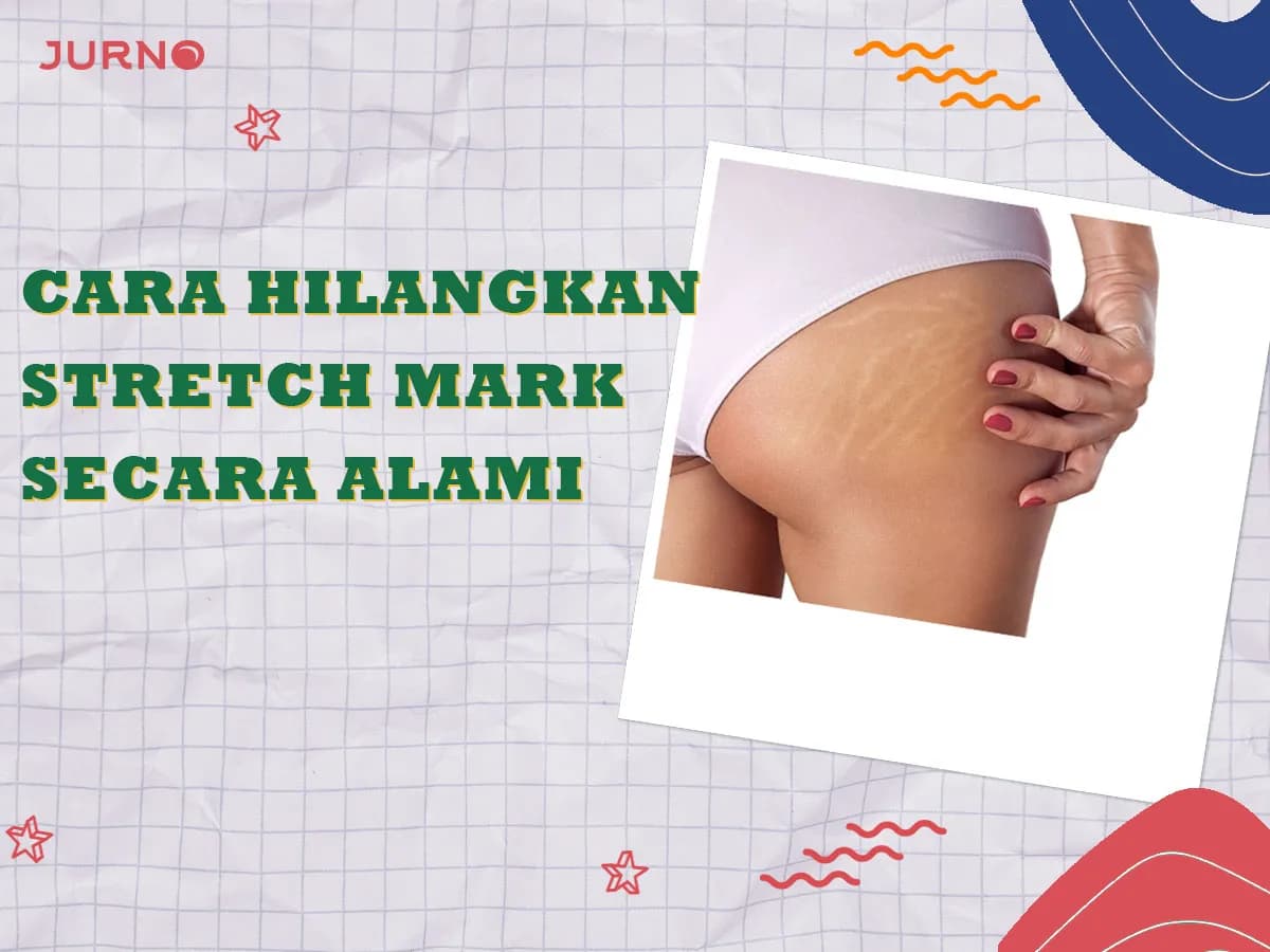Ini Dia Cara Menghilangkan Stretch Mark Secara Alami yang Terbukti Ampuh